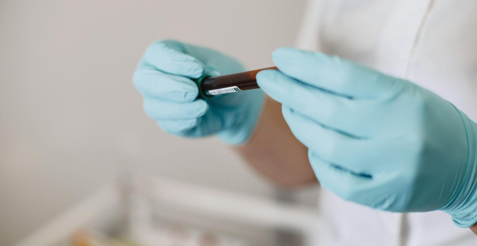 Examens biologiques en EHPAD : ce que change l’arrêté du 4 février 2026